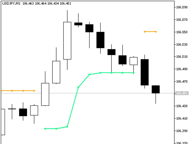 JBrain Trend1 Stop Alert